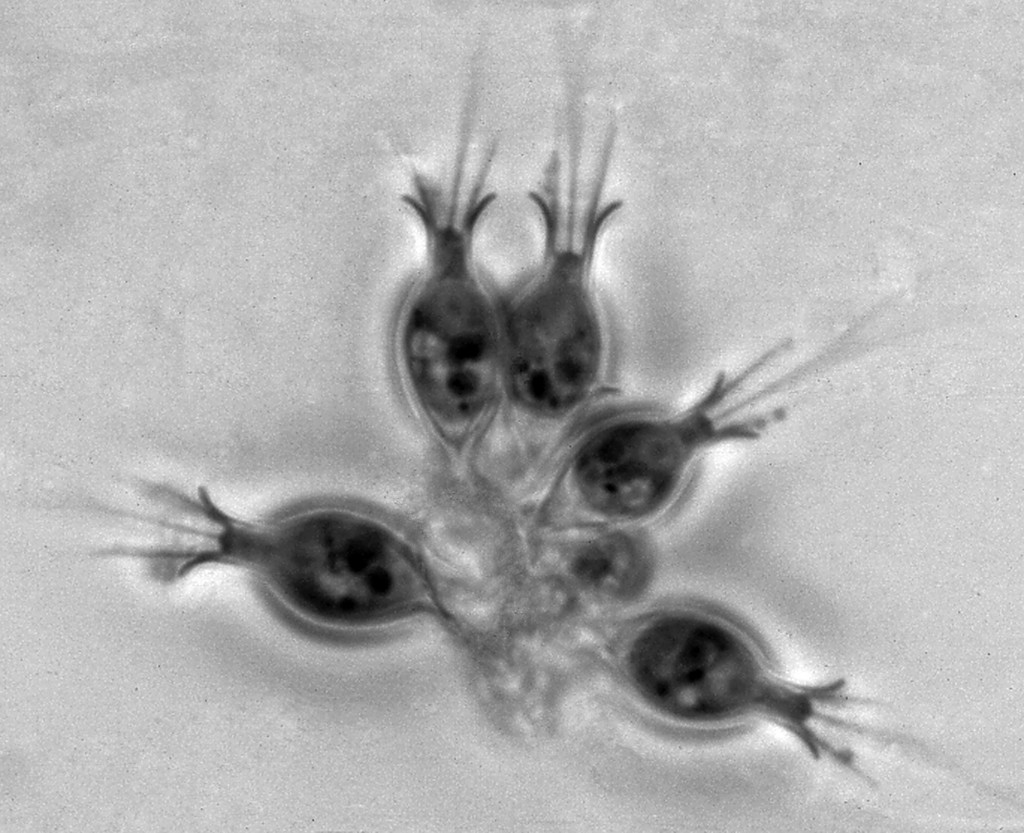 Salpingoeca sp. - Choanoflagellate. Photo: Barry S. C. Leadbeater.